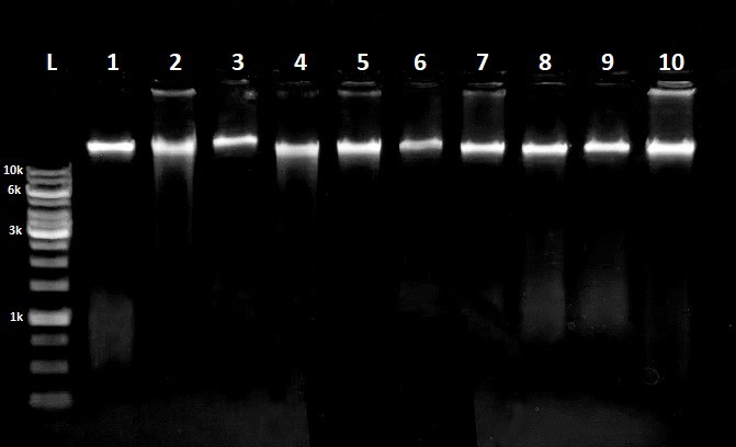 Salivalyse PCR gel results